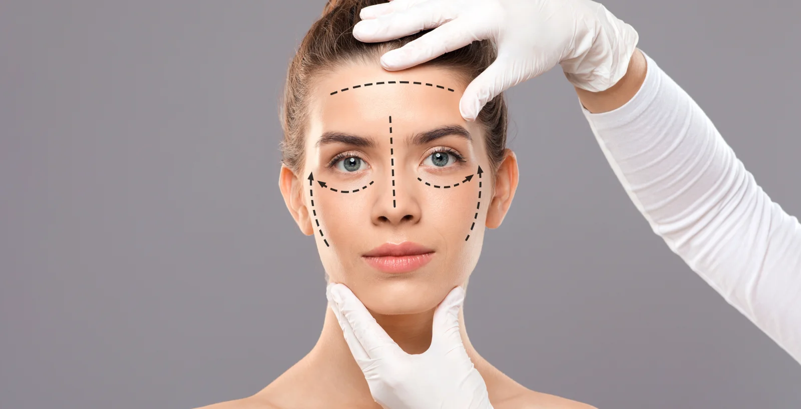 Ritidoplastia o Lifting Facial